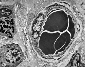 venule in lamina propria venule in lamina propria